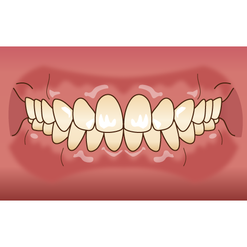 西東京市の矯正歯科・小児歯科専門医院 おおうち矯正歯科小児