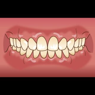 西東京市の矯正歯科・小児歯科専門医院 おおうち矯正歯科小児